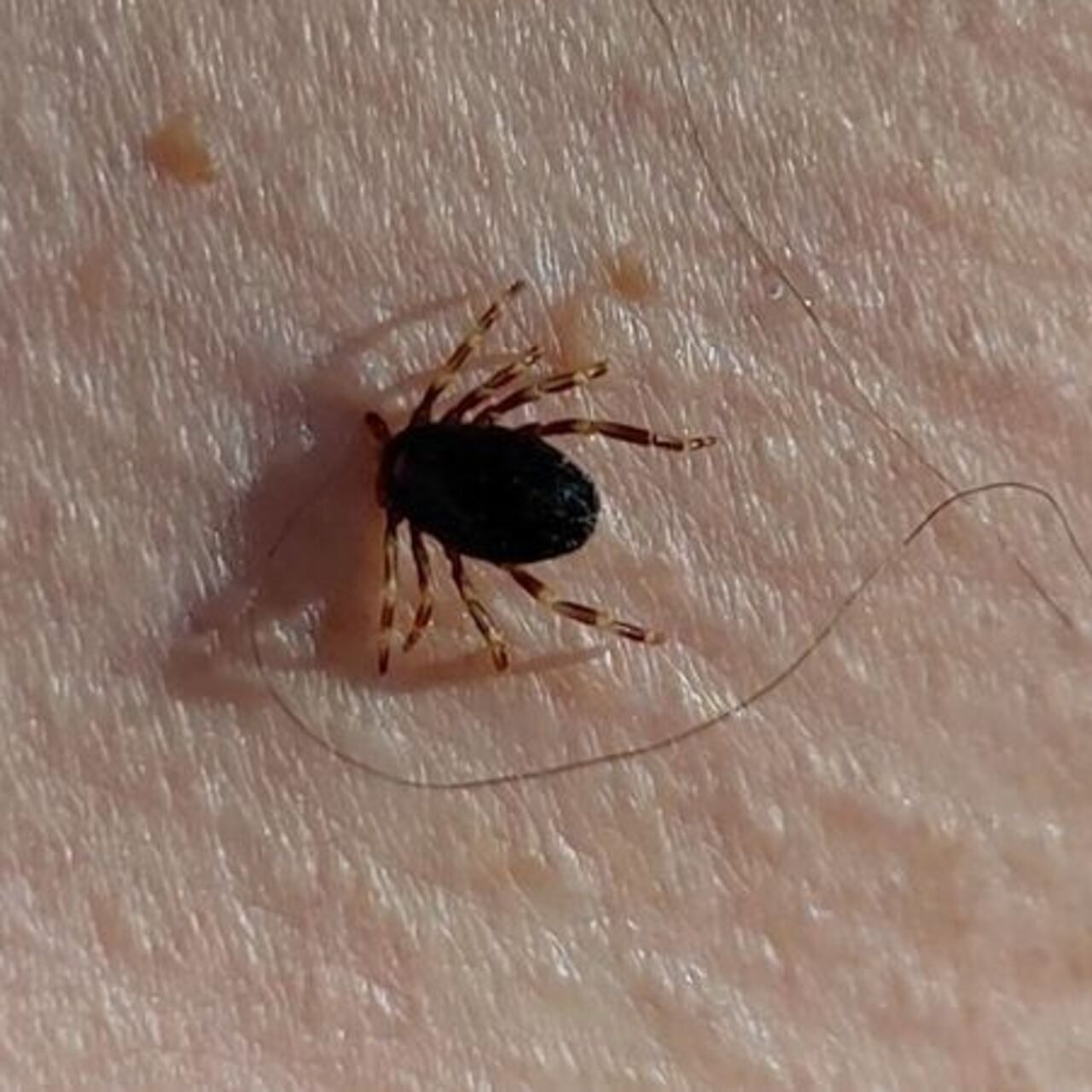 Sivas’ta KKKA alarmı! 6 kişi tedavi altında