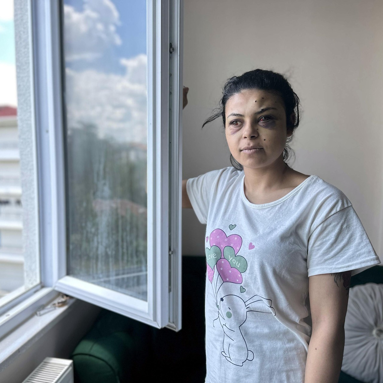 Sokak düğününde maganda ateşi! Saçmalar gözüne isabet etti!