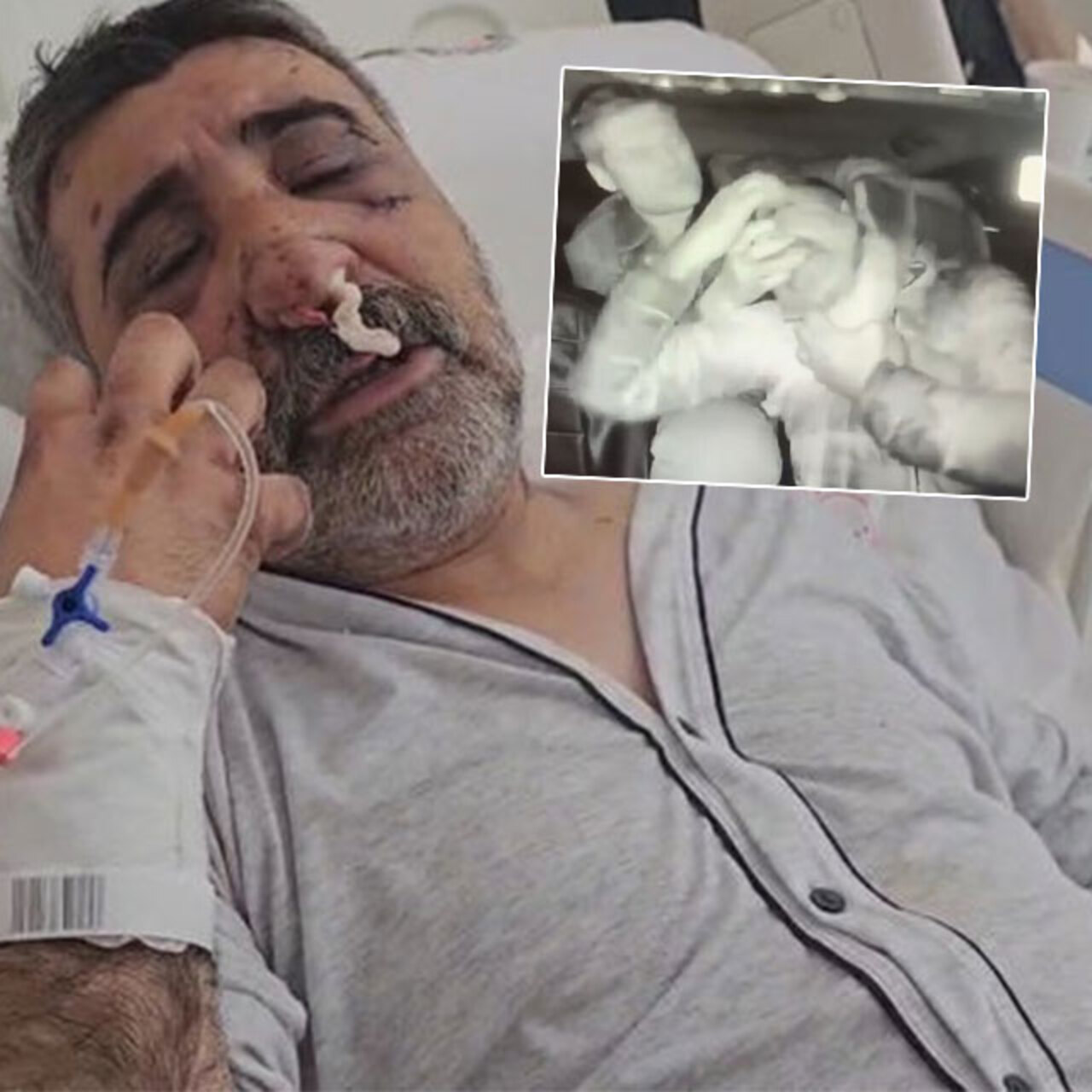 Taksici bayıltan şiddeti anlattı! “Gözlerimi oymaya çalıştı!”